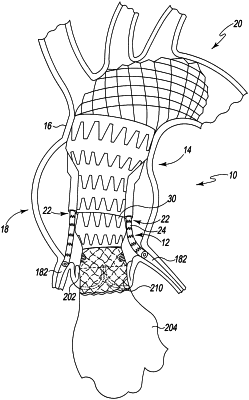 OG exemplary drawing