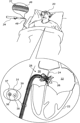 OG exemplary drawing