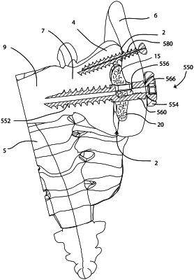 OG exemplary drawing