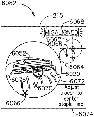 OG exemplary drawing