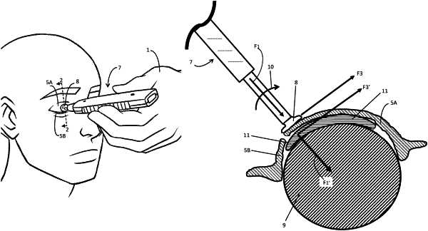 OG exemplary drawing