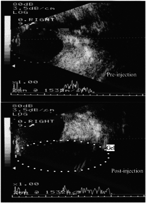 OG exemplary drawing