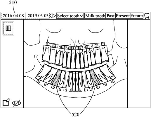 OG exemplary drawing