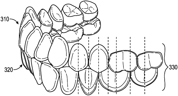 OG exemplary drawing