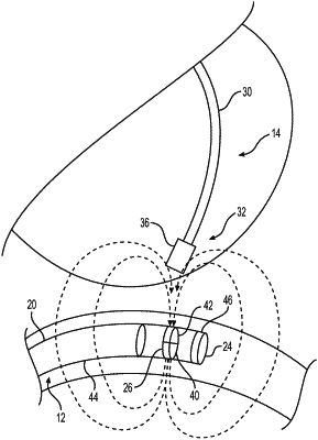 OG exemplary drawing