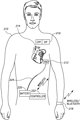 OG exemplary drawing