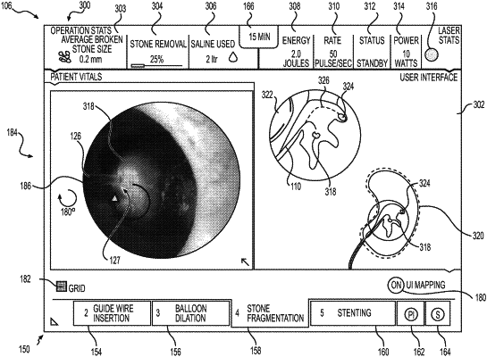 OG exemplary drawing