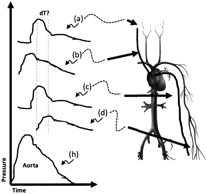 OG exemplary drawing