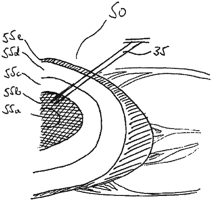 OG exemplary drawing