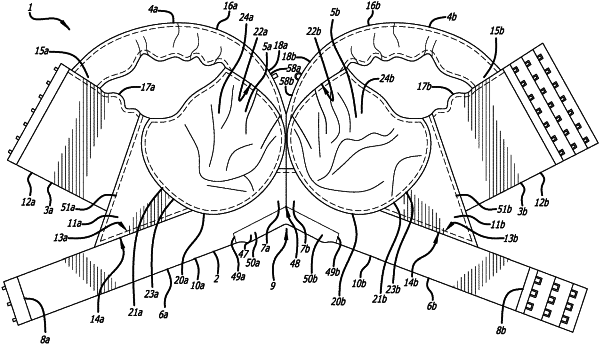 OG exemplary drawing