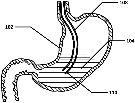 OG exemplary drawing