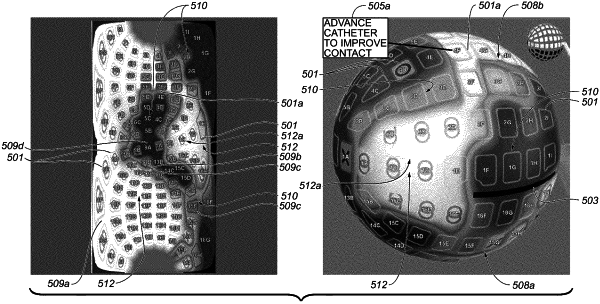 OG exemplary drawing