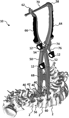 OG exemplary drawing