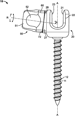 OG exemplary drawing