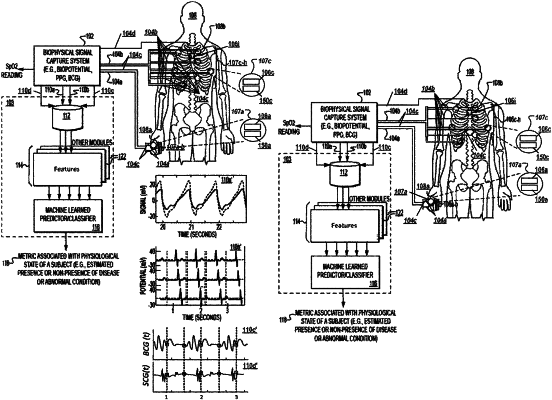 OG exemplary drawing