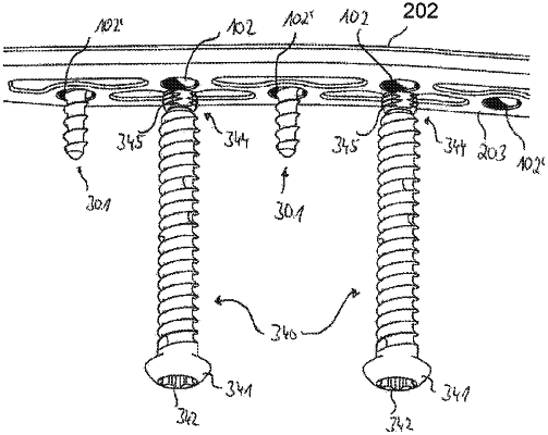 OG exemplary drawing